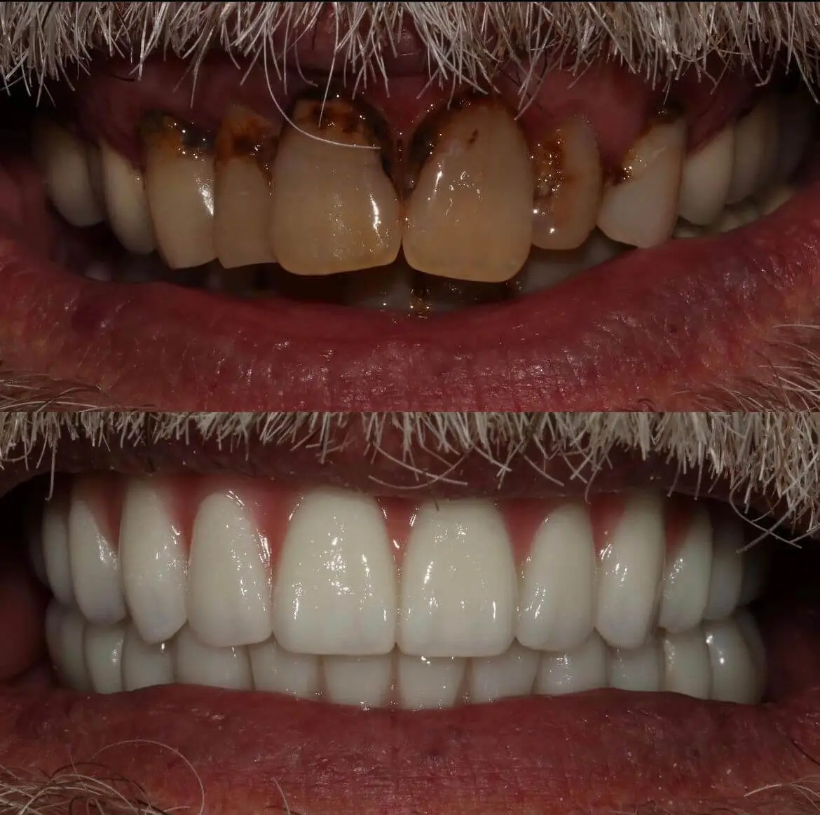 image1 (1)